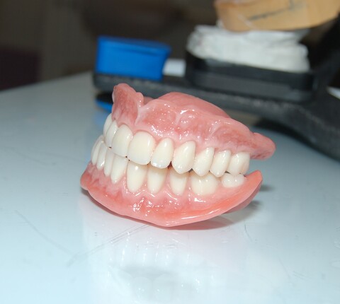 Изготовление акрилового полного съемного протеза Candulor (Швейцария)